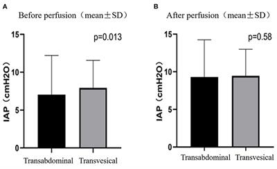 The Correlation Between Intra-Abdominal Pressure and Tolerance to Postoperative Hyperthermic Intraperitoneal Chemotherapy for Pseudomyxoma Peritonei